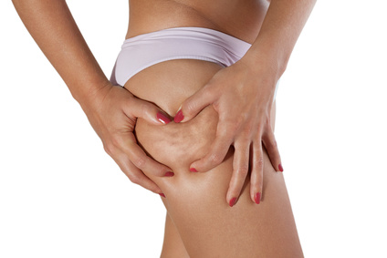 Graisse localisée ou cellulite